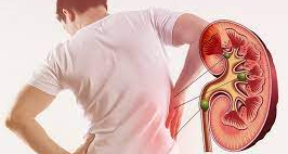 Dấu hiệu bệnh thận và suy thận